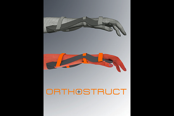 Orthostruct 3D Visualisierung